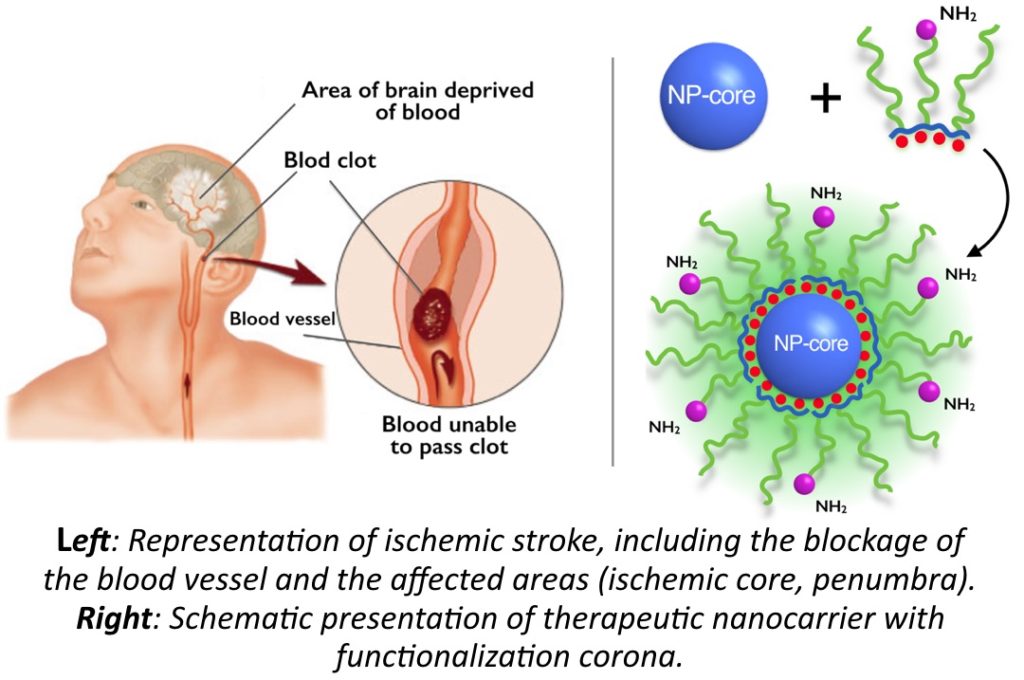 Illustration of a stroke event and theranostic nanoparticles